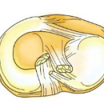 meniscusinjury3