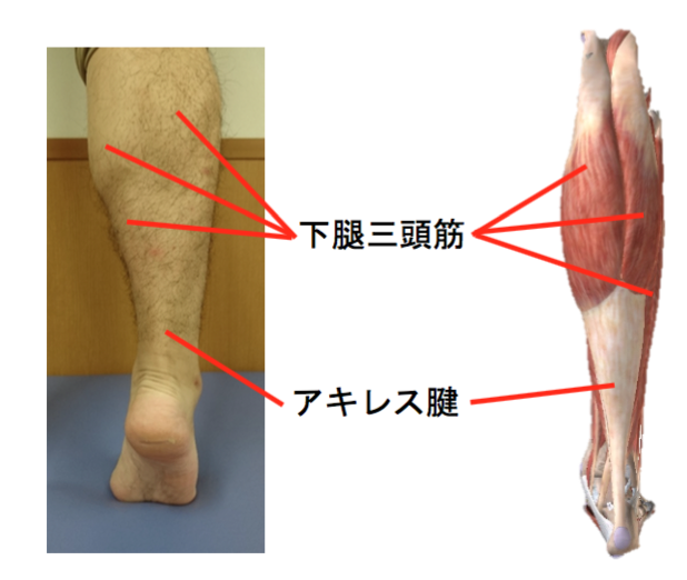 アキレス腱断裂 り整形外科クリニック 公式 神戸市東灘区 スポーツ整形外科