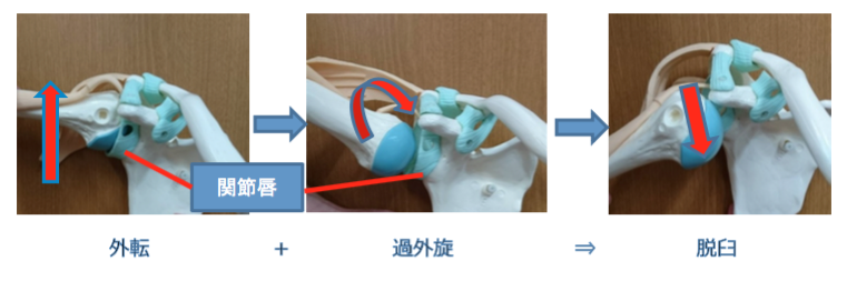 反復性肩関節脱臼 り整形外科クリニック 公式 神戸市東灘区 スポーツ整形外科