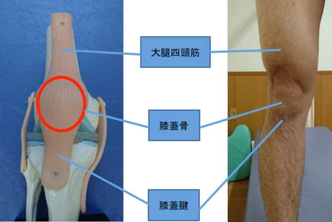 ジャンパー膝 膝蓋腱炎 神戸市東灘区 り整形外科クリニック 公式 整形外科 リハビリ科